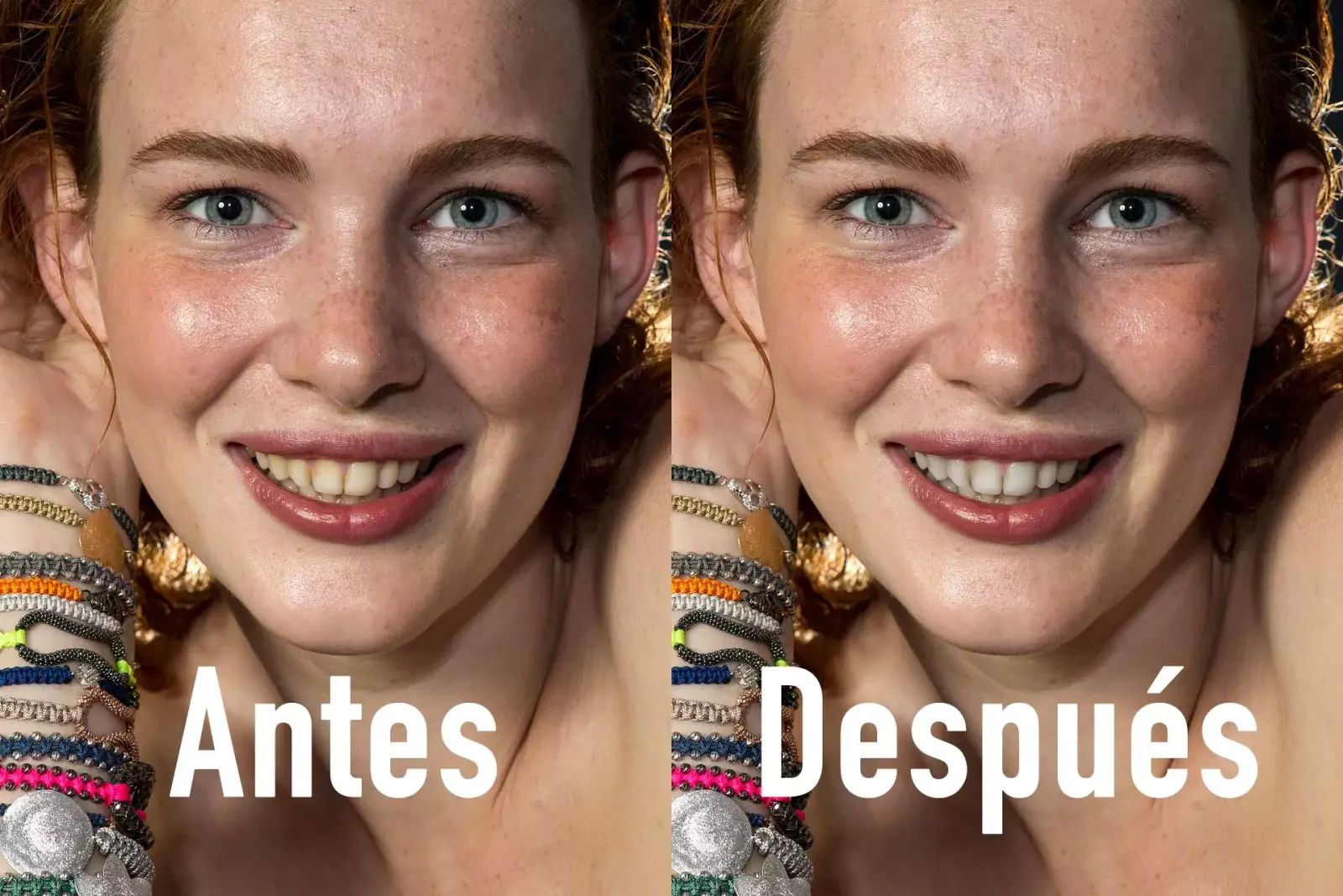 Before and after whitening teeth in Photoshop